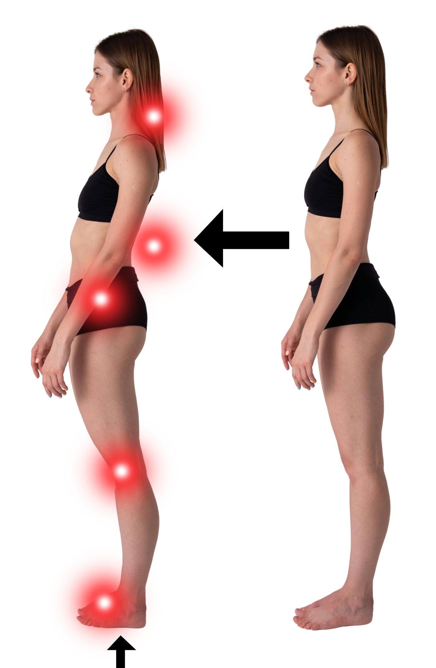 So beeinflusst die Fehlstellung der Füße den gesamten Körper